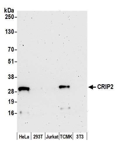 Polyclonal Rabbit anti-Human CRIP2 Antibody (aa75-125, WB)