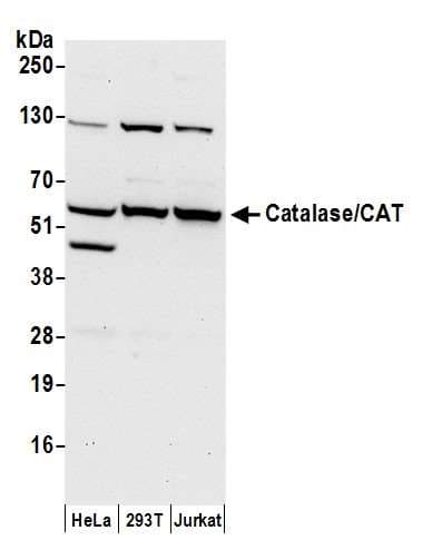 CAT / Catalase Antibody (aa477-527)