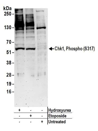 Polyclonal Rabbit anti-Human CHEK1 / CHK1 Antibody (phospho-Ser371, IHC, WB)