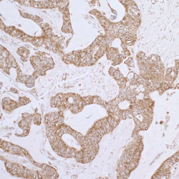 Polyclonal Rabbit anti-Human DLD / Diaphorase / E3 Antibody (aa459-509, IHC, WB)