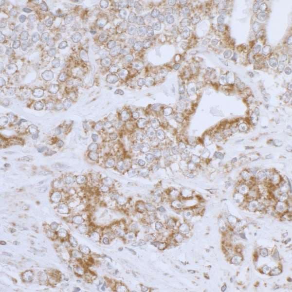 Polyclonal Rabbit anti-Human DLD / Diaphorase / E3 Antibody (aa459-509, IHC, WB)