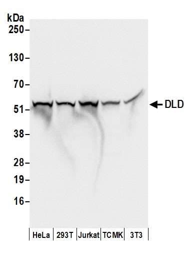 Polyclonal Rabbit anti-Human DLD / Diaphorase / E3 Antibody (aa459-509, IHC, WB)