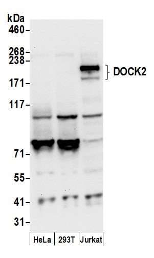 Polyclonal Rabbit anti-Human DOCK2 Antibody (aa1775-1825, WB)