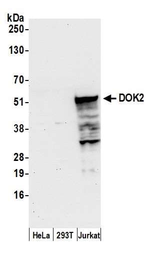 DOK2 Antibody (aa125-175)