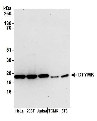 Thymidylate Kinase Antibody (aa162-212)