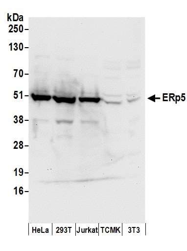 Polyclonal Rabbit anti-Human PDIA6 / ERP5 Antibody (aa390-440, IHC, WB)