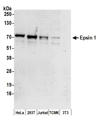 Polyclonal Rabbit anti-Human Epsin 1 / EPN1 Antibody (aa475-525, WB)