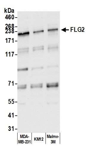 FLG2 Antibody (aa100-150)