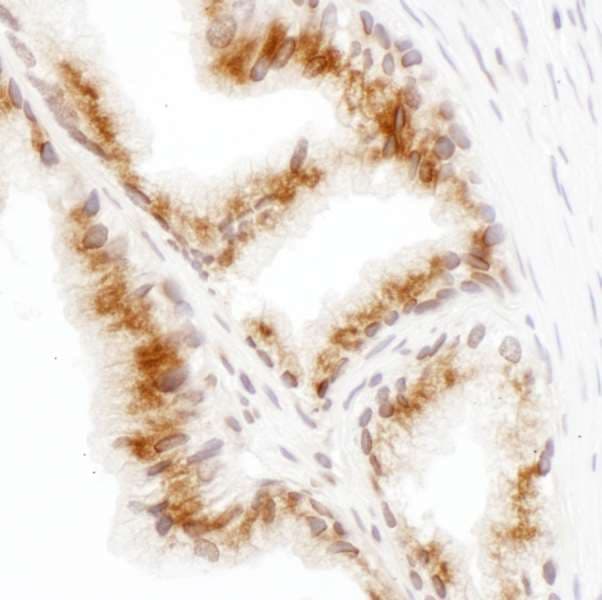 Polyclonal Rabbit anti-Human GORASP2 / GRASP55 Antibody (aa400-450, IHC, WB)