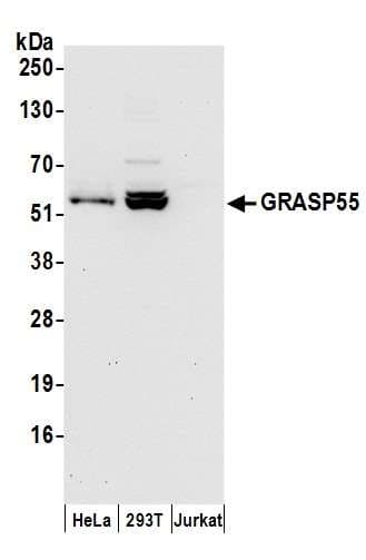 Polyclonal Rabbit anti-Human GORASP2 / GRASP55 Antibody (aa400-450, IHC, WB)
