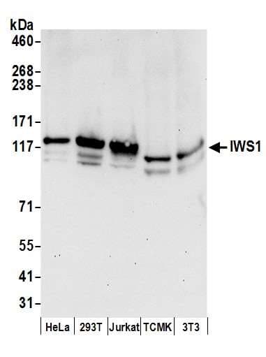 IWS1 Antibody (aa1-50)