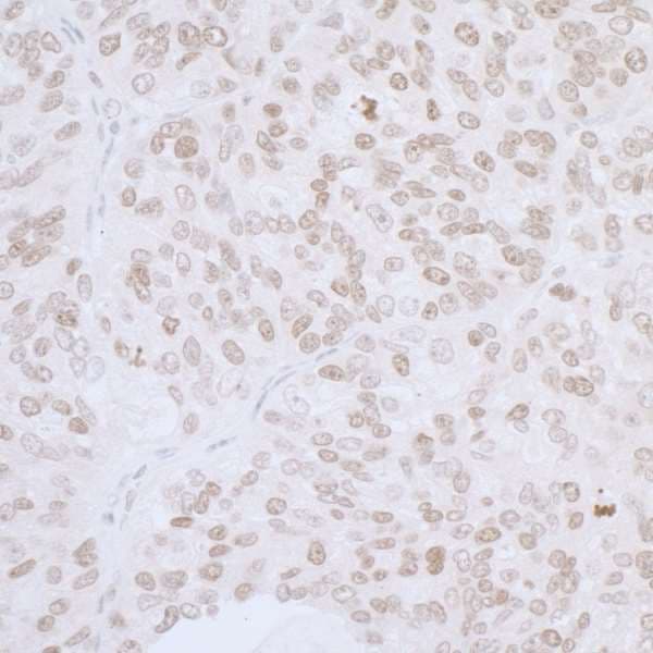 Polyclonal Rabbit anti-Human TMPO / TP / Thymopoietin Antibody (aa200-250, IHC, WB)