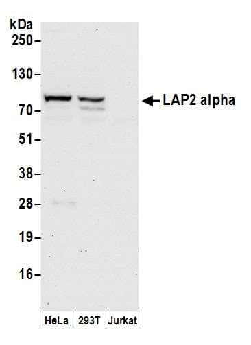 Polyclonal Rabbit anti-Human TMPO / TP / Thymopoietin Antibody (aa200-250, IHC, WB)
