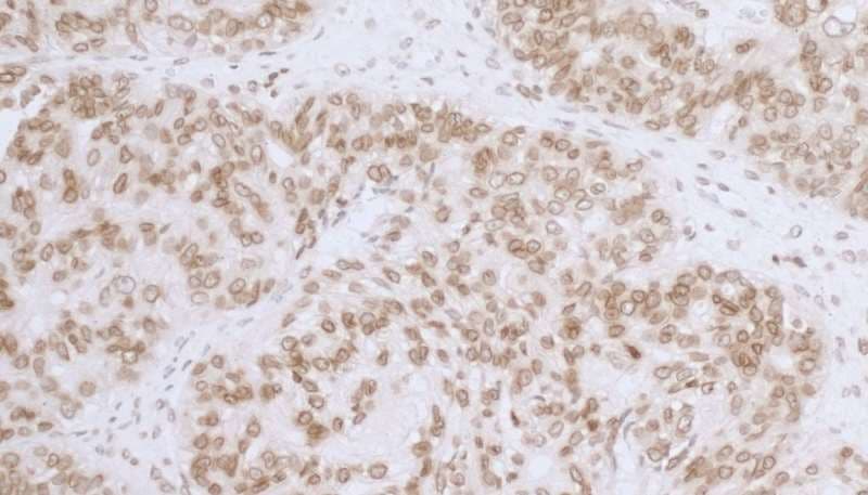 Polyclonal Rabbit anti-Human TMPO / TP / Thymopoietin Antibody (aa404-454, IHC, WB)