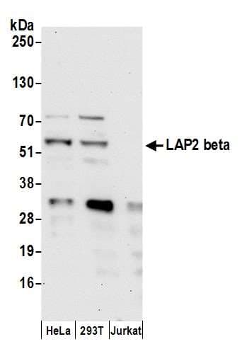 Polyclonal Rabbit anti-Human TMPO / TP / Thymopoietin Antibody (aa404-454, IHC, WB)