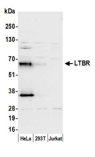 Polyclonal Rabbit anti-Human LTBR Antibody (aa385-435, WB)