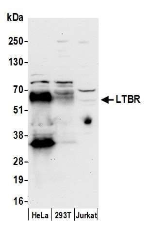 Polyclonal Rabbit anti-Human LTBR Antibody (aa385-435, WB)