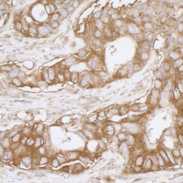 Polyclonal Rabbit anti-Human MVP / VAULT1 Antibody (aa843-893, IHC, WB)