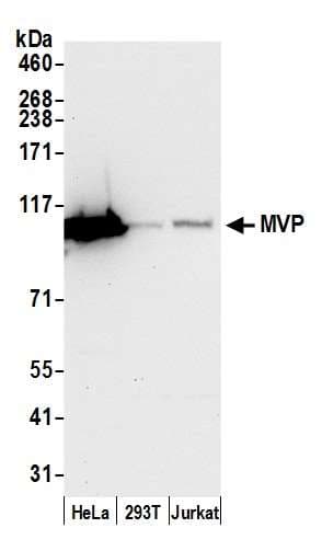 Polyclonal Rabbit anti-Human MVP / VAULT1 Antibody (aa843-893, IHC, WB)