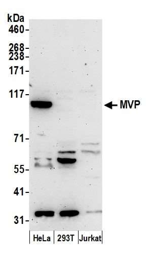 Polyclonal Rabbit anti-Human MVP / VAULT1 Antibody (aa1-50, IHC, WB)