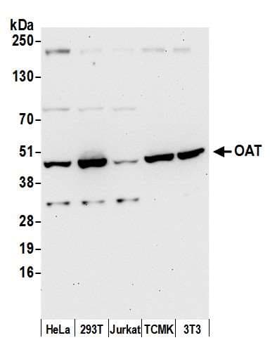 Polyclonal Rabbit anti-Human OAT Antibody (aa25-75, WB)