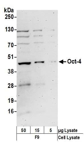 Polyclonal Rabbit anti-Mouse POU5F1 / OCT4 Antibody (aa1-50, WB)