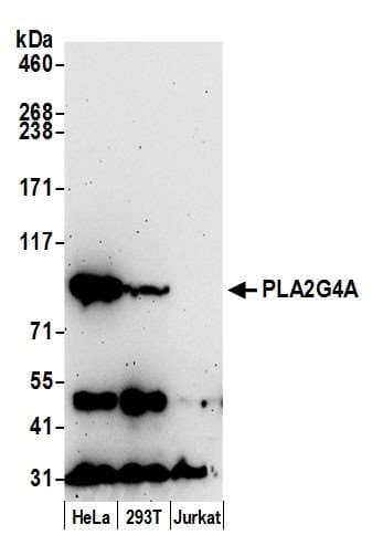 Polyclonal Rabbit anti-Human PLA2G4A Antibody (aa699-749, WB)