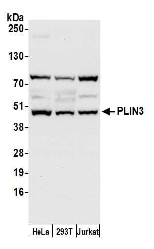 Polyclonal Rabbit anti-Human PLIN3 / M6PRBP1 / TIP47 Antibody (aa125-175, WB)