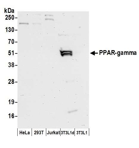 Polyclonal Rabbit anti-Human PPARG / PPAR Gamma Antibody (aa50-100, WB)
