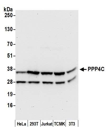 Polyclonal Rabbit anti-Human PPP4C Antibody (aa1-307, WB)