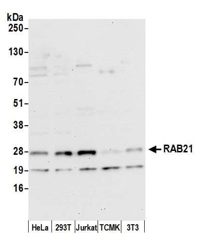 Polyclonal Rabbit anti-Human RAB21 Antibody (aa172-222, WB)