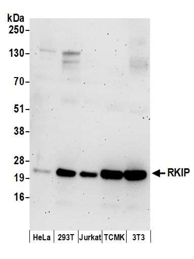 Polyclonal Rabbit anti-Human PEBP1 / RKIP Antibody (aa137-187, WB)