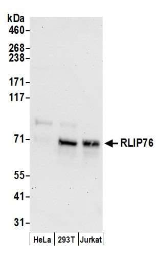 Polyclonal Rabbit anti-Human RIP1 / RALBP1 Antibody (aa605-655, WB)