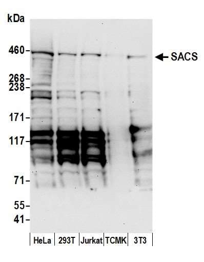 SACS / Sacsin Antibody (aa175-225)