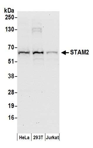 Polyclonal Rabbit anti-Human STAM2 Antibody (aa175-225, WB)