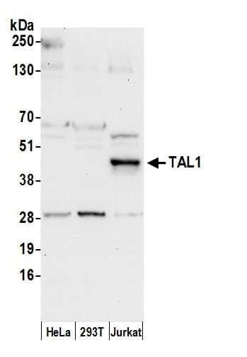 TAL1 Antibody (aa1-50)