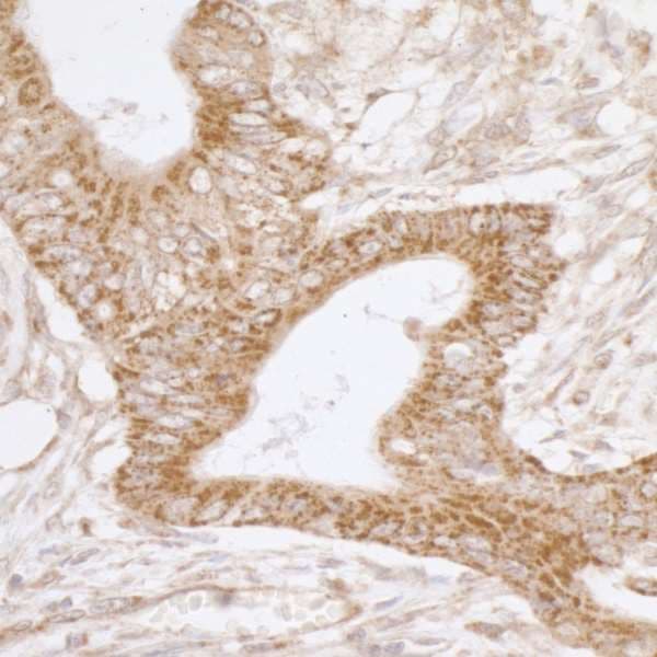 Polyclonal Rabbit anti-Human TRAP1 / HSP75 Antibody (aa50-100, IHC, WB)