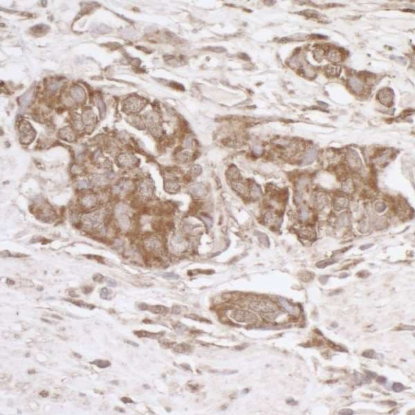 TRAP1 / HSP75 Antibody (aa600-650)