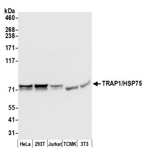Polyclonal Rabbit anti-Human TRAP1 / HSP75 Antibody (aa50-100, IHC, WB)