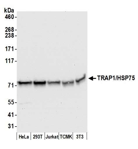TRAP1 / HSP75 Antibody (aa600-650)