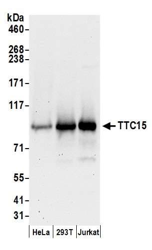 Polyclonal Rabbit anti-Human TRAPPC12 / TTC15 Antibody (aa50-100, WB)