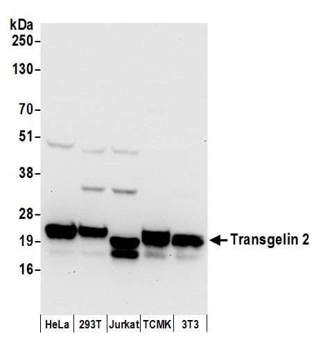 Polyclonal Rabbit anti-Human TAGLN2 / Transgelin 2 Antibody (aa111-161, WB)
