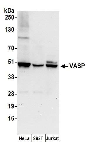 Polyclonal Rabbit anti-Human VASP Antibody (aa330-380, WB)
