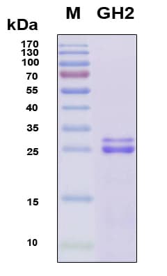 Human GH2 Protein (Recombinant 6His, N-terminus)