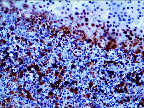 Monoclonal Mouse anti-Human SMAD4 Antibody (IHC)