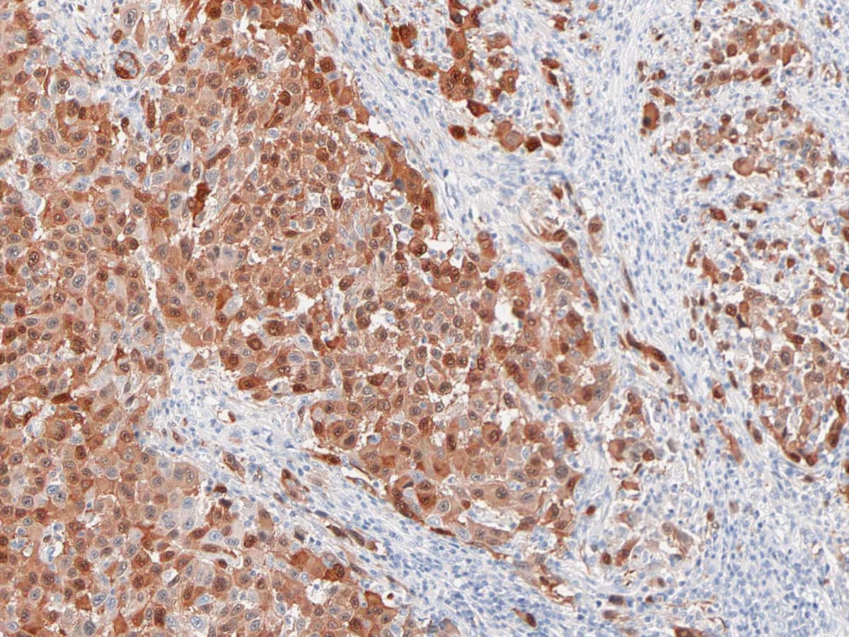 S100 Protein Antibody (Ready-to-Use)