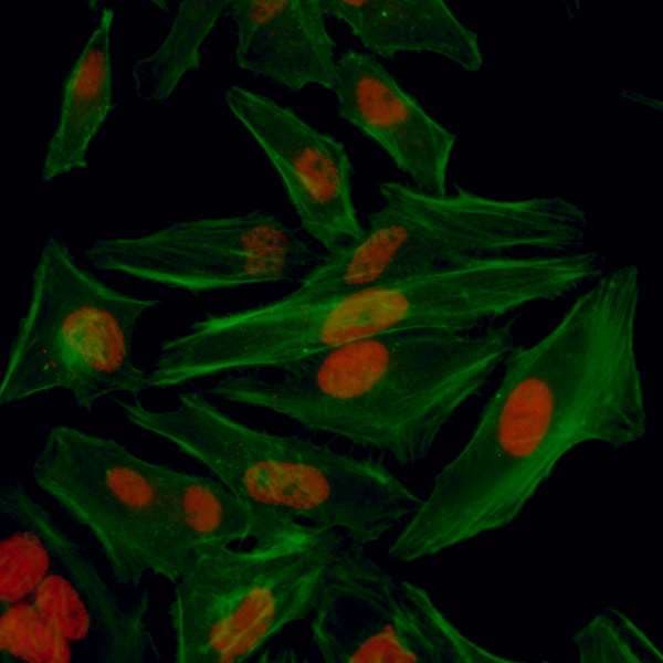 HIF1A / HIF1 Alpha Antibody (aa775-C-term)
