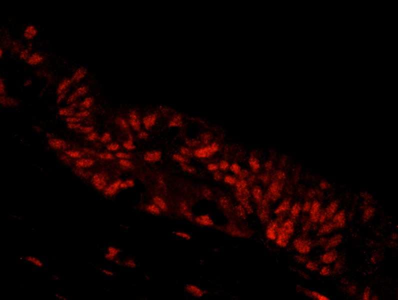 Polyclonal Rabbit anti-Human NBN / Nibrin Antibody (aa704-754, IHC, IF)