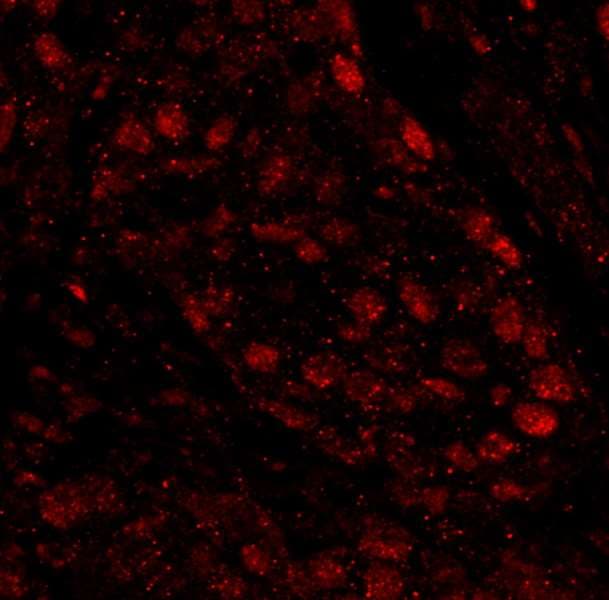 PARP1 Antibody (aa50-100)