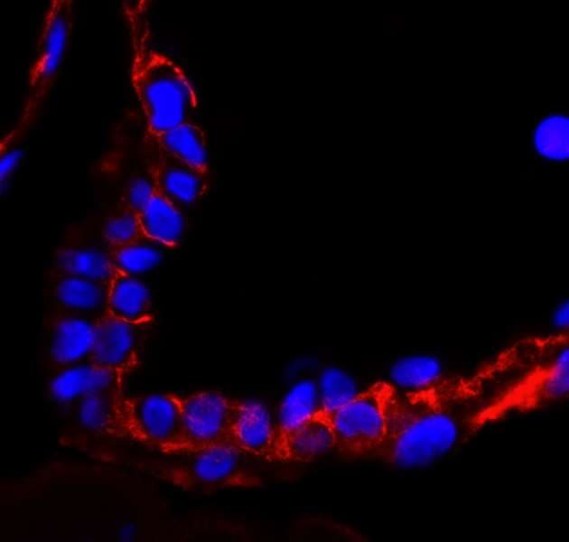 Polyclonal Rabbit anti-Human EGFR Antibody (aa1150-C-term, IHC, IF)